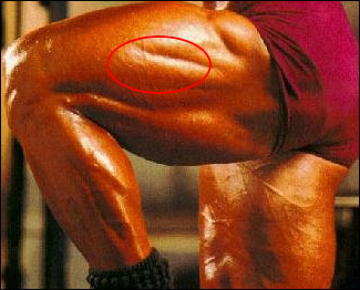 Injektion Oberschenkel - Zaubertrank & Muskelbowle - Bodybuilding und Fitness Forum