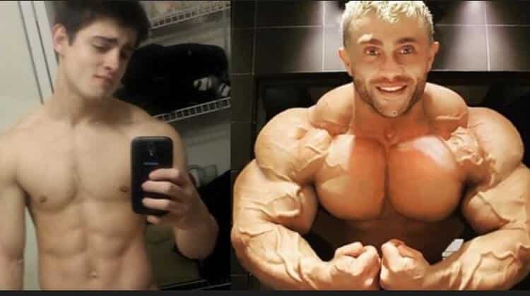 Is Boldenone Injection Good Option for Bodybuilders - Anabolic Coach