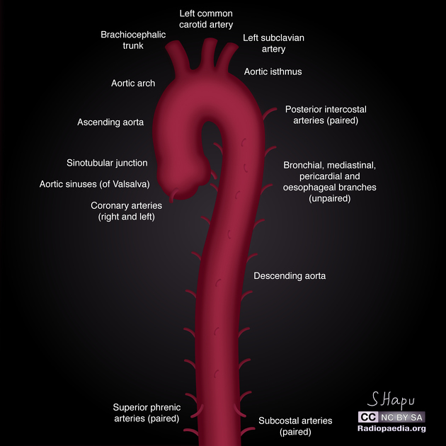 Thoracic Descending Aorta Anatomy And Its Branches