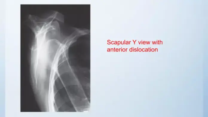 X ray views of shoulder joint and related structures | PPTX X ray views of shoulder joint and related structures | PPTX